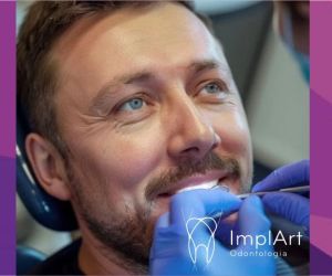 MANUTENCAO-IMPLANTES-1 Novo Implante Straumann iEXCEL: implante rápido com osseointegração em 21 dias