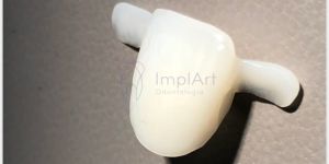 Protese_adesiva_41kb Implantes dentário antes e depois