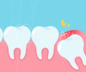 Dente_siso_doendo_50kb Sonhar Com Dente Caindo Ou Quebrado