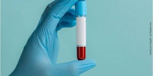 Enxerto_osseo_com_plasma_50kb Implante ortodôntico: mini implante