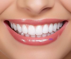 quantos-implantes-posso-fazer O que é enxerto ósseo dentário