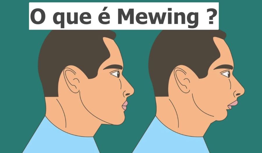 o-que-e-mewing-3 O que é Mewing?