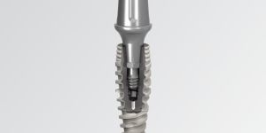 implante_cone_morse_straumann_50kb Implante dentário: Qual o preço de um implante dentário / quanto custa e preço médio