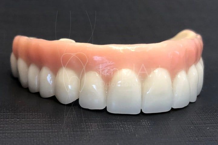 protese_fixa_porcelana_zirconia_protocolo_dentadura_50kb Prótese protocolo: complicações possíveis
