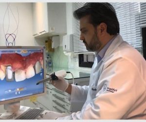planejamento_computadorizado_dos_tratamentos_50kb Implante dentário em quem usa aparelho ortodôntico
