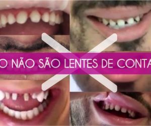 isso-nao-e-lente-site Dentista o profissional que cuida do seu sorriso