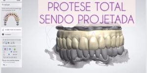 protese_dentaria_projeto_3D_40kb Epilepsia e a Odontologia: tratamento dental e implante dentário