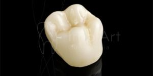 coroa zirconia estetica cerec 50kb 00776696