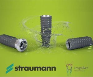 prótese fixa straumann