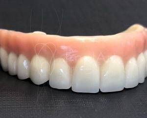 protese fixa porcelana zirconia protocolo dentadura 50kb 346e6e55