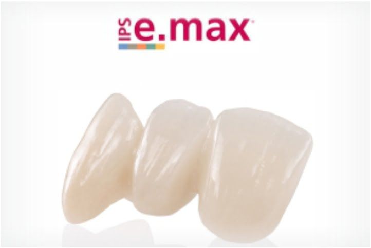 coroas ceramica emax 50kb 3d21610f