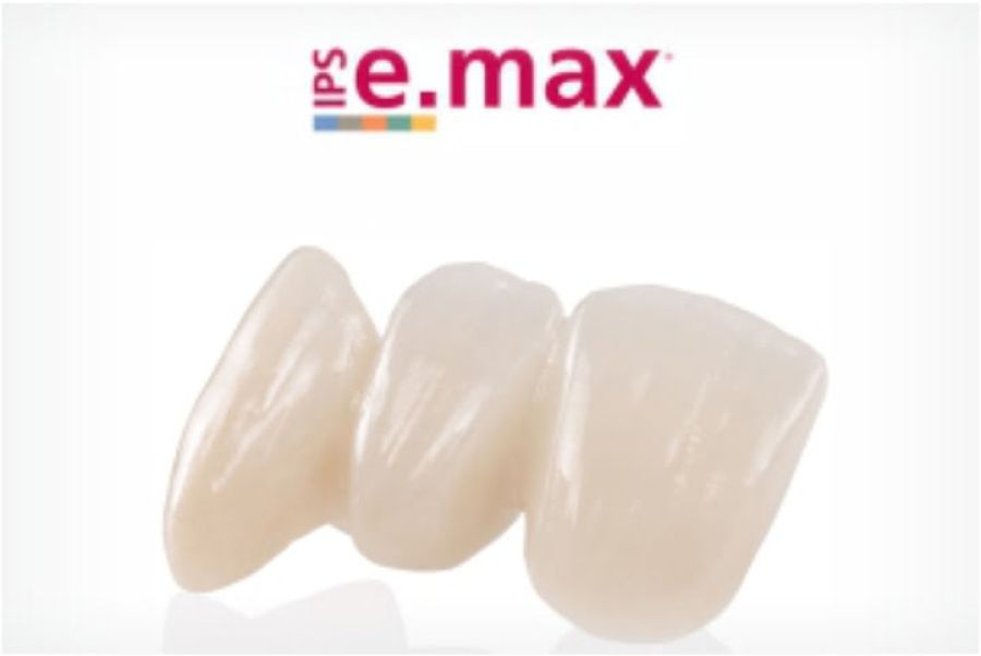 coroas ceramica emax 50kb 5baafa01