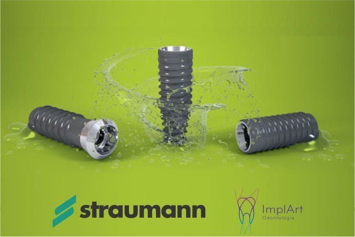 prótese fixa straumann