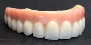 protese fixa porcelana zirconia protocolo dentadura 50kb a45d014f