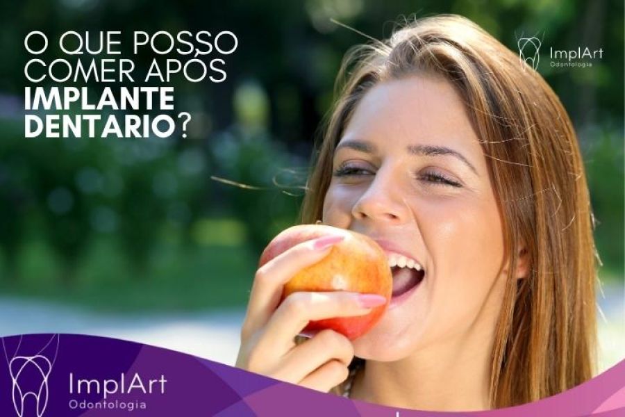Implantes dentários: alimentação e cuidados após a cirurgia 1 o que comer após cirurgia de implante dentario