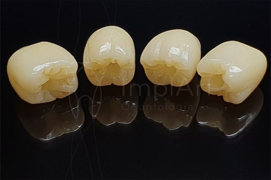 coroas zirconia zolid 50kb d270a06b