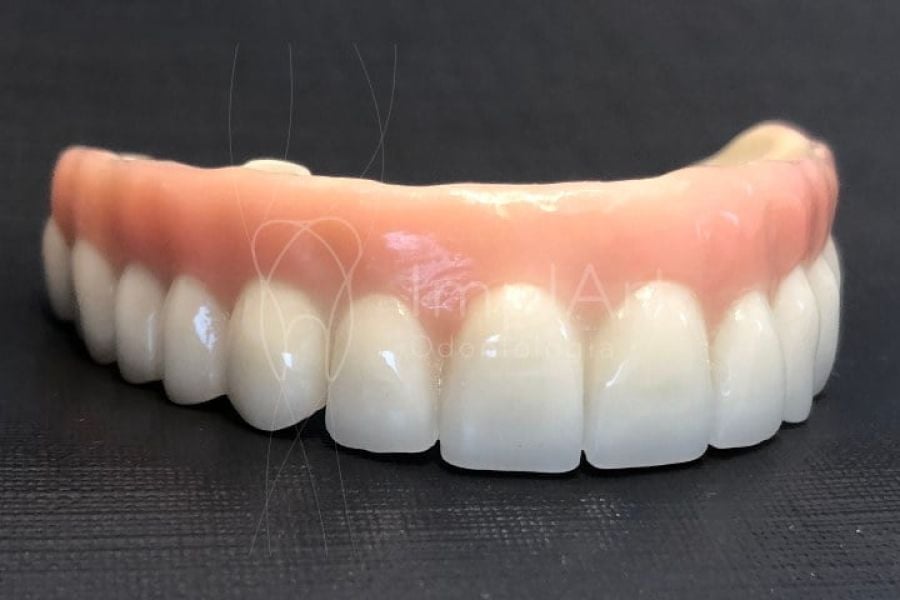 protese fixa porcelana zirconia protocolo dentadura 50kb d511698b