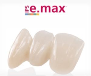 coroas ceramica emax 50kb f5613d72