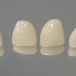 dente_zirconia_porcelana