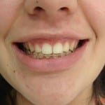 estetica_dental