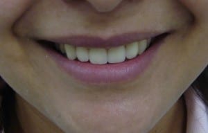 estetica dental2