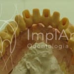 implante_dentario_total__estrutura