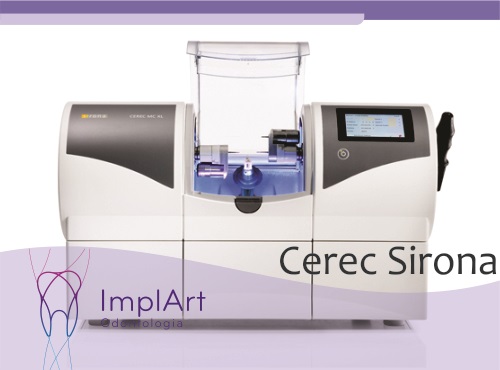 Lente de contato dental no Cerec