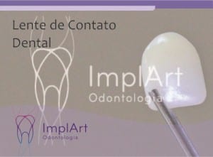 implantes dentario