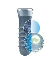 Como ocorre a Osseointegração de Implantes Dentários?