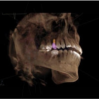 ImplArt agora oferece Tomografia Computadorizada 3D