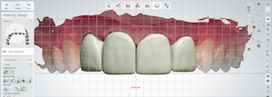 Planejamento dental Computadorizado – resultados mais controlados