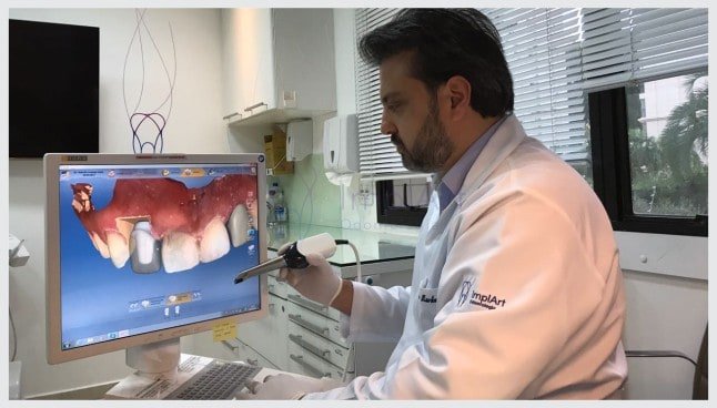 Planejamento dental computadorizado –  resultados mais controlados