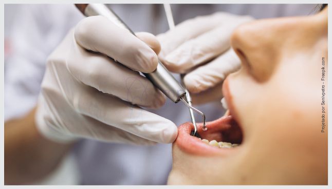 Limpeza dental e raspagem no dente com anestesia evita a sensibilidade