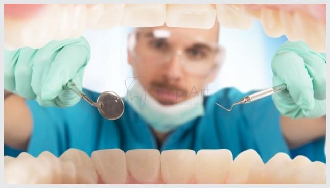 Implante Dentário: os 5 piores problemas com implantes