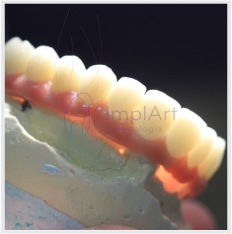 zirconia dental prontas