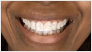 reabilitacao oral transformar sorriso 40kb