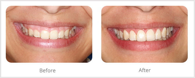 ImplArt – Spa odontológico – Clínica de implantes dentários e estética dental