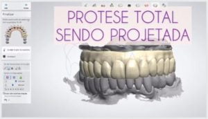 protese dentaria projeto 3D 40kb