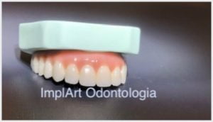 protese dentária fixa porcelana estetica zirconia translucida todos dentes 50kb