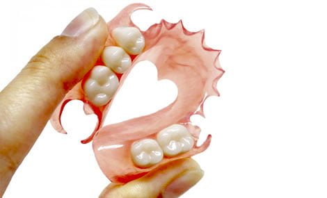 Prótese dentária removível: tipos, modelos e indicações