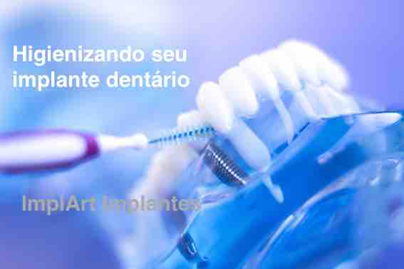limpeza do implante dentario