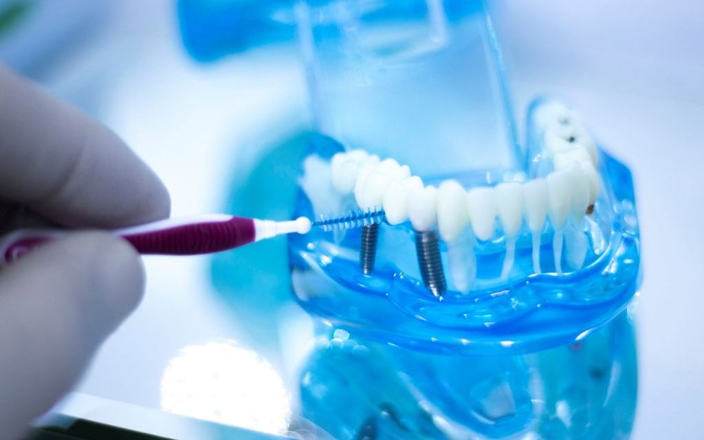 manutenção do implante dentario