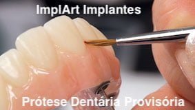 protese dentaria provisoria implante dentario