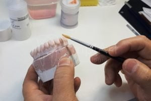 aplicacao ceramica protese fixa zirconia 50kb