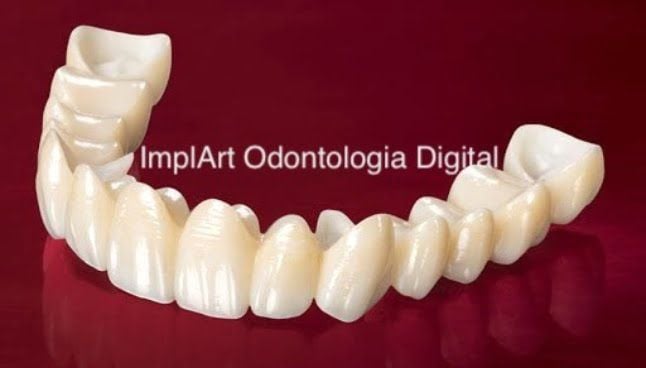 0502b55c Prótese dentária fixa de porcelana sobre dentes com ou sem gengiva