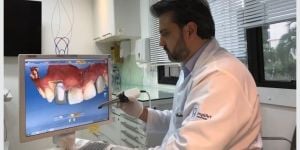 planejamento_computadorizado_dos_tratamentos_50kb-0791763c Moldagem computadorizada com Scanner Intraoral