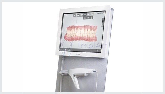 trios_scanner_intraoral_21kb-1092a6ed Projeto de prótese dentária em 3D