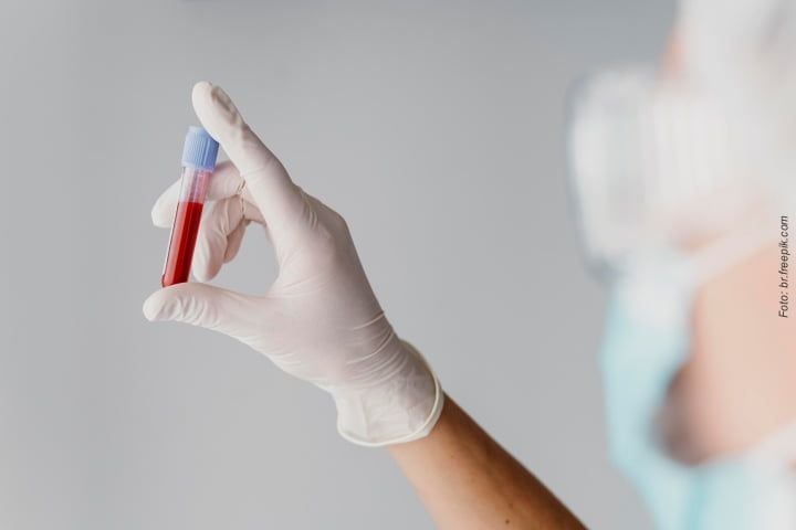 plasma_rico_em_fibrina_enxerto_50kb-14d5f68b Enxerto ósseo com plasma rico em fibrina
