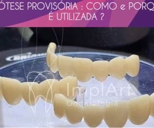 25ffea2f Especialista em implantes dentarios - Implantodontista Dr. Roberto Markarian