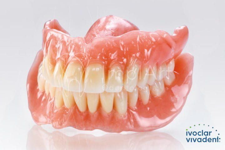 dentadura_moderna_protese_movel_50kb-273da52a Dentaduras modernas: cuidados e novas técnicas
